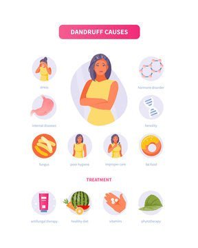 Causes of Dandruff Explained