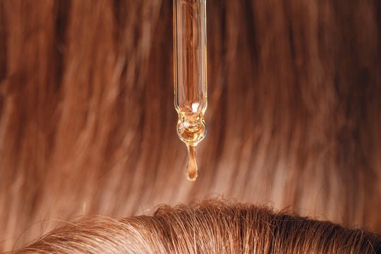 Which Hair Oil Is Best For Dandruff? Rosemary vs Coconut vs Tea Tree Oil