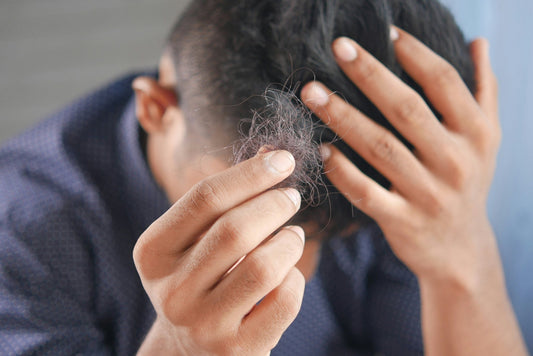 Seborrheic Dermatitis and Hair Loss - A Physician Explains