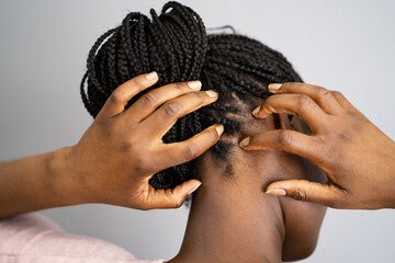 No, That's Not Dandruff - It's Psoriasis! The Difference Explained