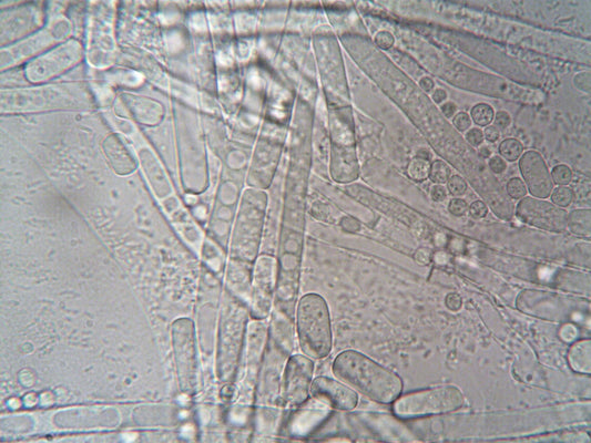 Malassezia Globosa: The Yeast Behind Dandruff? A Doctor Explains