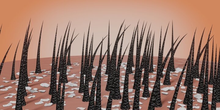Dander Under Microscope How Dandruff Looks Under The Microscope - A Doctor Looks and Explains ...