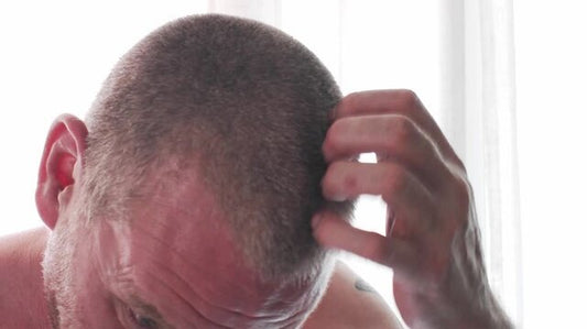 Itchy Scalp and No Evidence of Dandruff? Here's Why