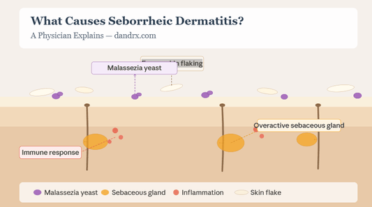 What causes Seborrheic Dermatitis? A Physician Explains