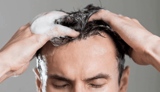 Different Types of Dandruff and How to Identify Yours