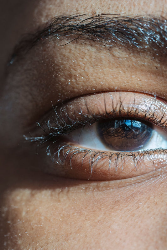 Eyebrow Dandruff: A Doctor Explains the Causes and Best Treatments
