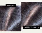 DandRX Shampoo + Conditioner