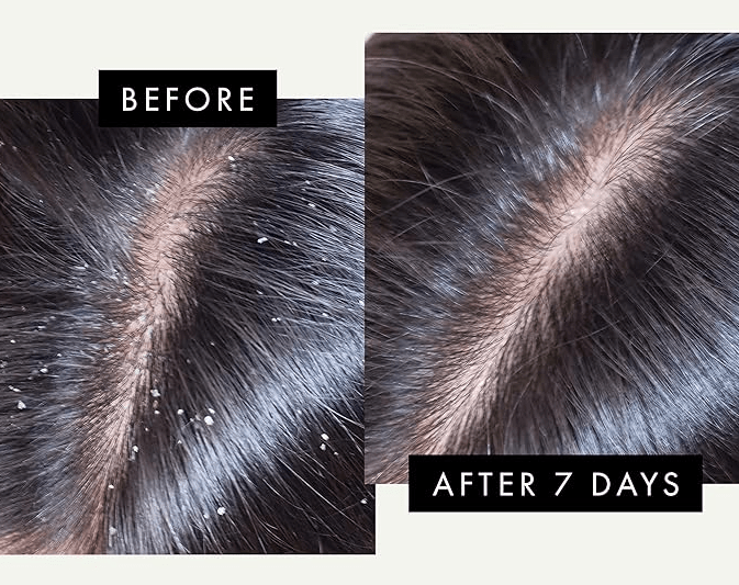 DandRX Shampoo + Conditioner