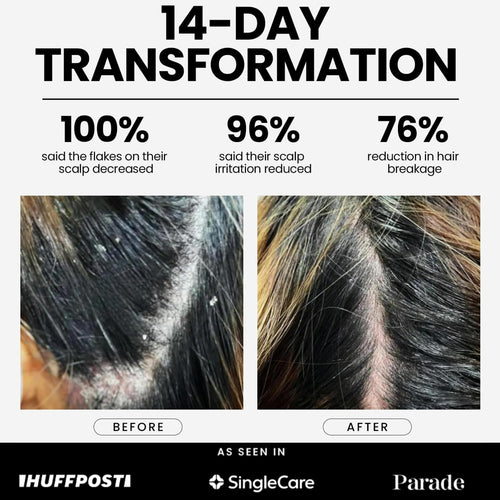 DandRX Shampoo + Conditioner